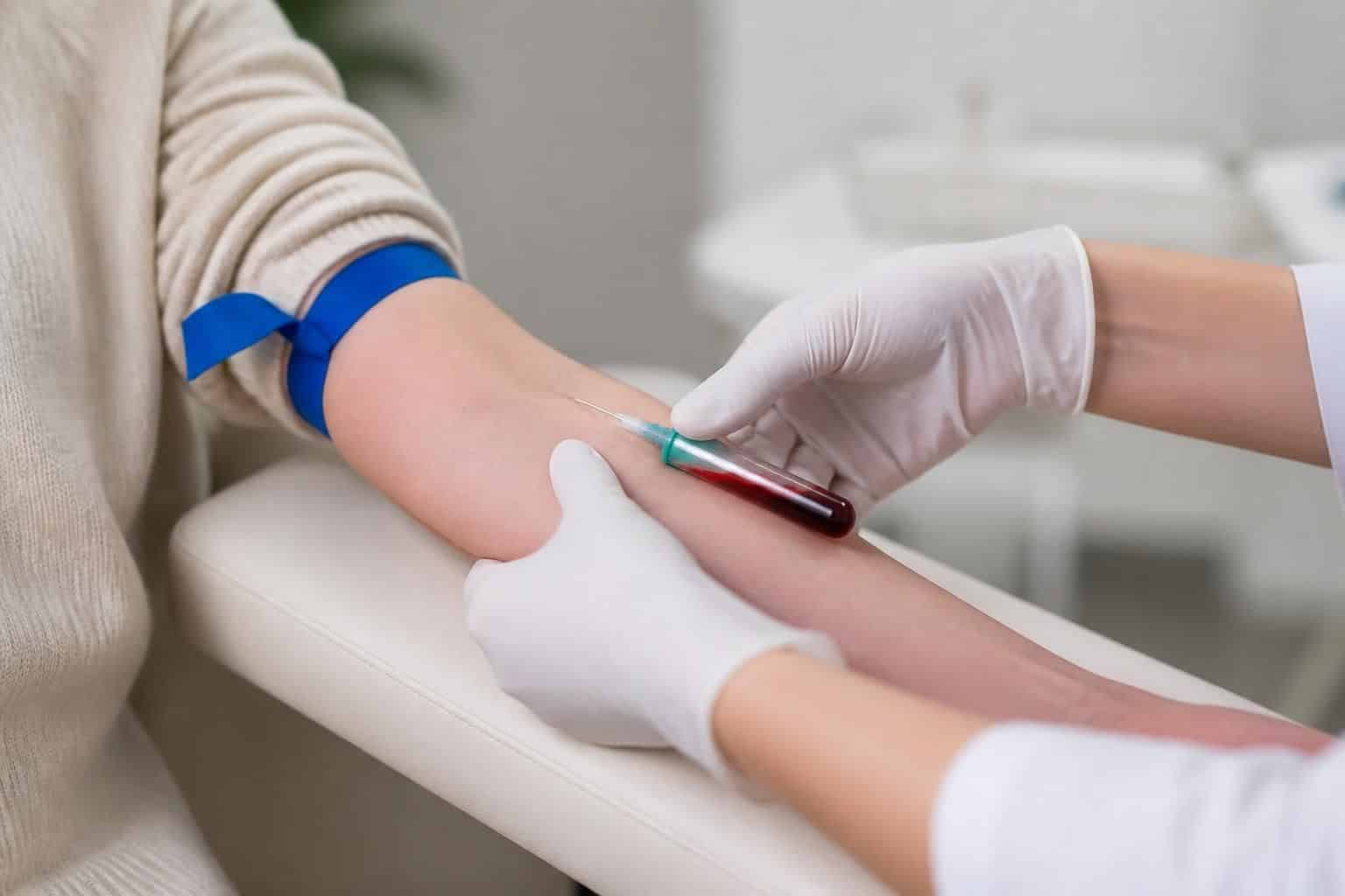 découvrez comment le stress influence les niveaux de d-dimère et leurs effets sur la santé, pour une meilleure compréhension et gestion du bien-être.