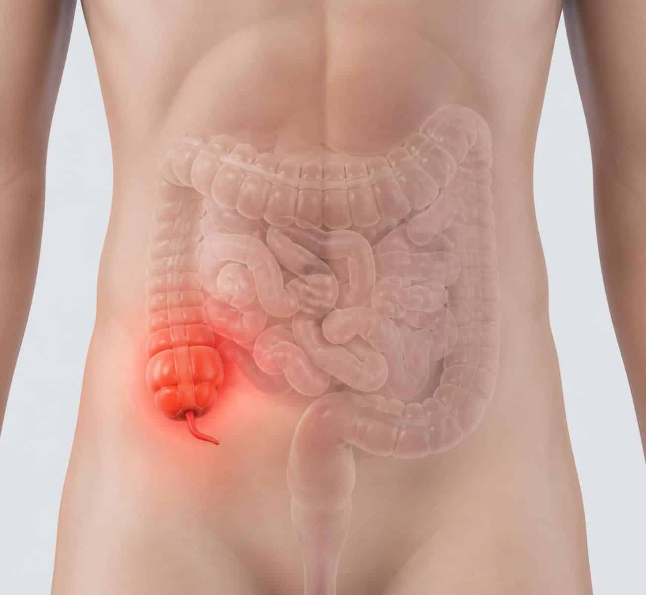 découvrez les causes, les symptômes et les signes de la douleur liée à l'appendicite pour mieux comprendre cette urgence médicale et agir rapidement.