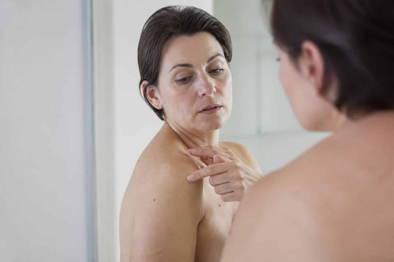 découvrez comment identifier un grain de beauté dangereux grâce à une photo avec nos conseils essentiels pour protéger votre santé.